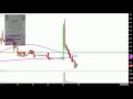 FIBROCELL SCIENCE INC. - Fibrocell Science, Inc. - FCSC Stock Chart Technical Analysis for 05-25-18