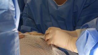 Healing through innovation: Using artificial human skin for major wound recovery