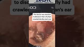 VIETNAM HOLDING LIMITED ORD USD1 Doctor in Vietnam Extracts Fly From Patient&#39;s Ear 😱