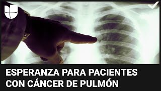 Ponen a prueba la primera vacuna contra el cáncer de pulmón: te explicamos cómo funciona