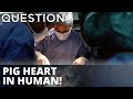 Maryland doctors transfer pig heart to human patient