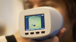 Leben retten mit einem neuen Testgerät für Hautkrebs