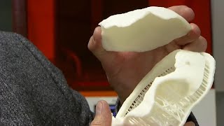 3 D SYS CORP. DL-.001 Un cráneo impreso en 3D salva la vida a un niño de 10 años