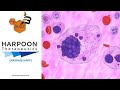 “The Buzz'' Show: Harpoon Therapeutics (NASDAQ: HARP) Interim Data From Multiple Myeloma Trial