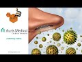 “The Buzz” Show: Auris Medical (NASDAQ: EARS) Provides Update on Bentrio Program in Allergy