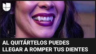 Cuidado con accesorios de Halloween: alertan sobre colmillos de vampiro que pueden romper dientes