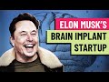 Should Elon Musk be trusted with human brains? Neurologist weighs in on Neuralink
