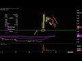 Cancer Genetics Inc - CGIX Stock Chart Technical Analysis for 11-20-19