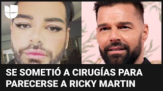 Hombre que se sometió a más de 30 cirugías para parecerse a Ricky Martin casi muere