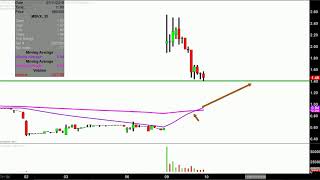 MABVAX THERAPEUTICS HOLDINGS MabVax Therapeutics Holdings, Inc. - MBVX Stock Chart Technical Analysis for 07-09-18