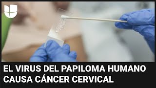 Así funcionará la prueba casera para detectar el virus causante del cáncer de cuello uterino