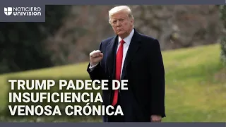 Trump es diagnosticado con insuficiencia venosa crónica tras informes de hinchazón en sus piernas