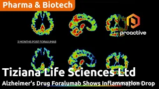 Tiziana Reports PET data sees reduced neuroinflammation in patient treated with Intranasal Therapy