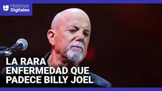 S&U PLC [CBOE] Qué es la hidrocefalia normotensiva, la rara enfermedad que obligó a Billy Joel a cancelar su gira