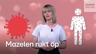 Steeds meer besmettingen: zo gevaarlijk zijn de mazelen