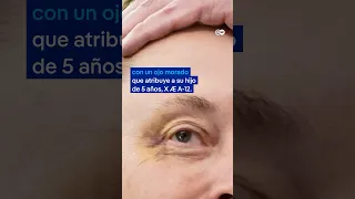 Musk se despide de la administración Trump con un ojo morado