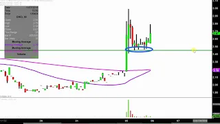 COMSTOCK HOLDING COMPANIES Comstock Holding Companies, Inc. - CHCI Stock Chart Technical Analysis for 11-05-18