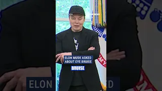 ELON AB [CBOE] OUCH: Elon Musk says eye bruise was caused by punch from his son X #foxnews #news #shorts