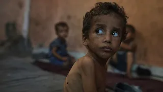 Gaza : la faim tue les plus jeunes, l’ONU tire la sonnette d’alarme