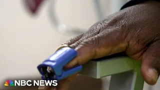 PULSE Researchers working to make pulse oximeters work better on all skin colors