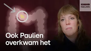 Steeds meer jonge mensen met darmkanker